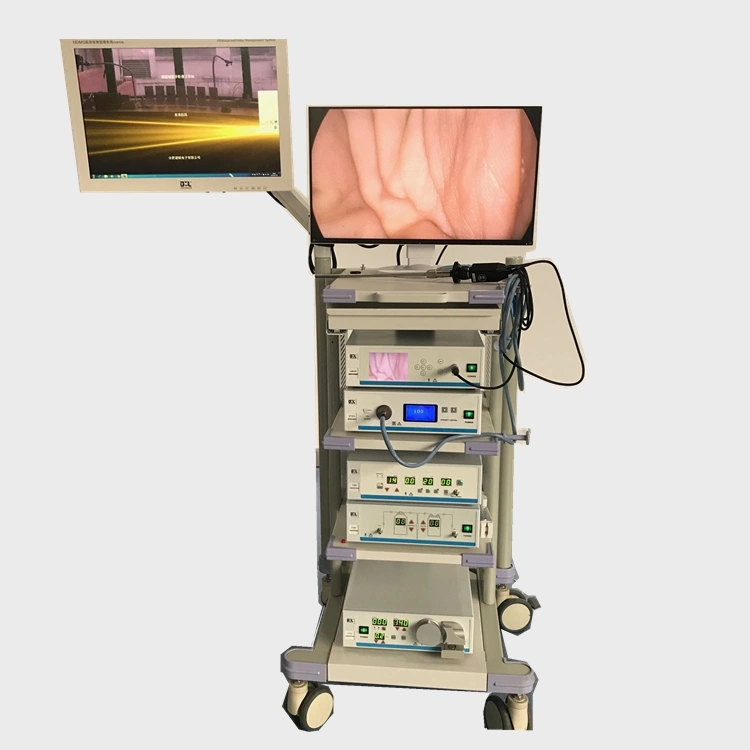 Medical Complete Arthroscopy Set HD Endoscopic Tower with Instruments Cystoscopy Tower Also Available