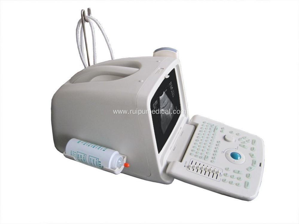 Price Ultrasound Machine Digital Ultrasound Scanner Portable
