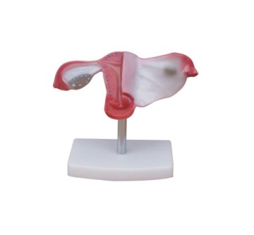 NATURAL UTERUS MODEL