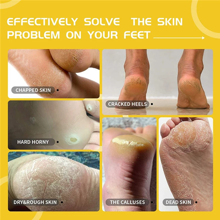 Custom Natural Honey Exfoliating Cracked Heels Repair Foot Peel Mask