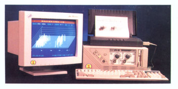 Type Digital Partial Discharge Detecting Analytic System