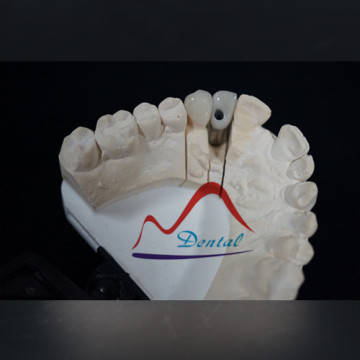 Cosmetic in Appearance Dental Zirconia