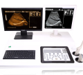 Mesin Ultrasound Trolley Digital Rumah Sakit dengan Workstation