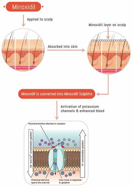 Minoxidil capsule