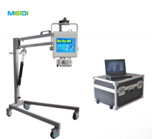 PORTABLE DIGITAL X- RAY MACHINE SYSTEM MODEL
