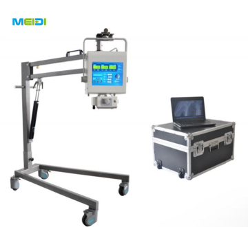 PORTABLE DIGITAL X- RAY MACHINE SYSTEM MODEL