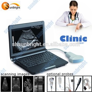 Human and Animal Pregnancy Scanner Ultrasound Black and White