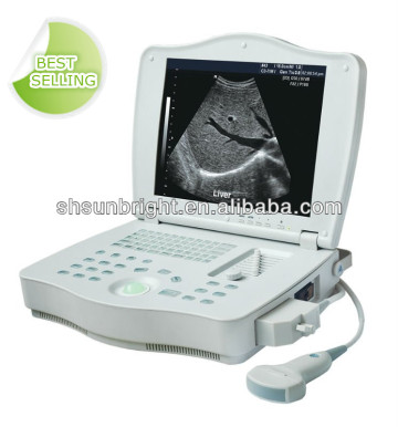ob ultrasound