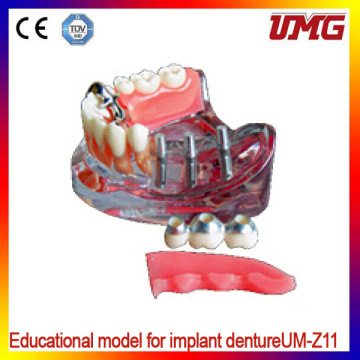 Dental Teeth Models and Implants Communication Model for Dentist