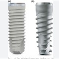 Implanted titanium alloy screw for surgical and dental