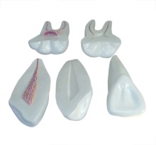 Expansion Model of Human Teeth