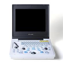 Children kidney stones ultrasound diagnostic instrument