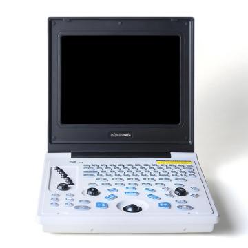 Children kidney stones ultrasound diagnostic instrument
