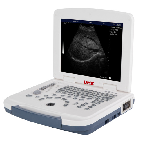 UW-580 Full-Digital Laptop Ultrasound Machine