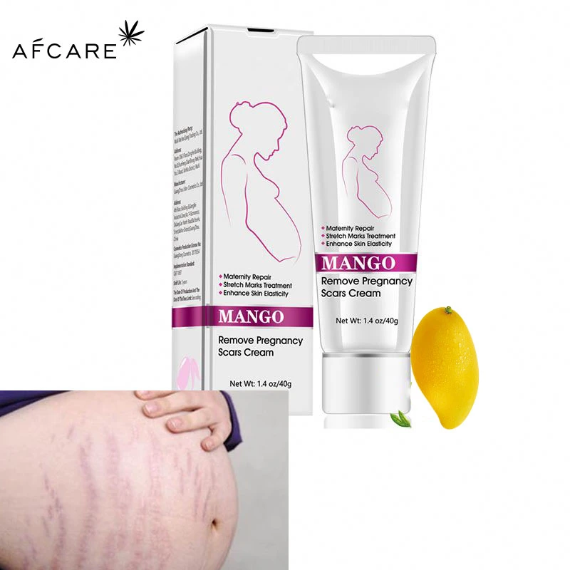 Amazon Hot Sale Best Natural Organic Herbal Collagen Anti Vergeture Repair Scar Stretch Mark Cream Removal Cream