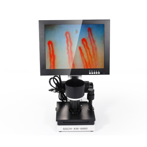 Detector de microscopio de micirculación de pliegue de uñas de 10 pulgadas