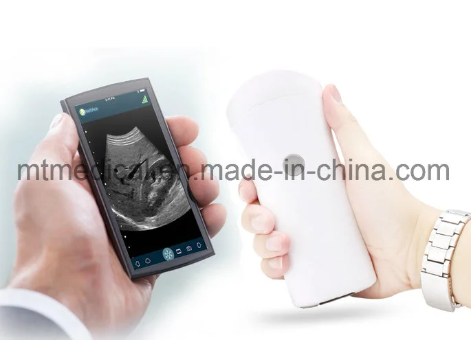 Portable 128 Elements Color Doppler Handheld Wireless Ultrasound Scanner Convex and Linear Probe