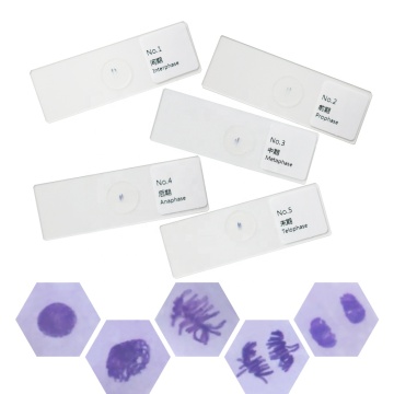 Onion Root Tip Mitosis Cell Stages Plant Genetics Biology Microscope Slides