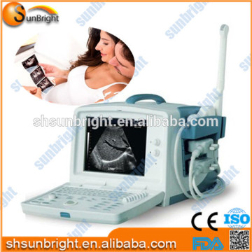 professional ultrasonic diagnostic equipment for OB/GYN hospital