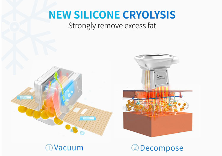 Cryo Slimming Machine For Sale