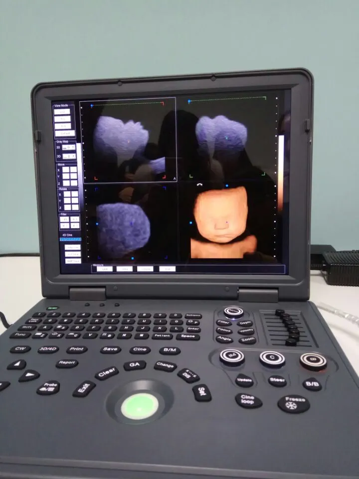 Upgraded Version Laptop Color Doppler Ultrasound Machine