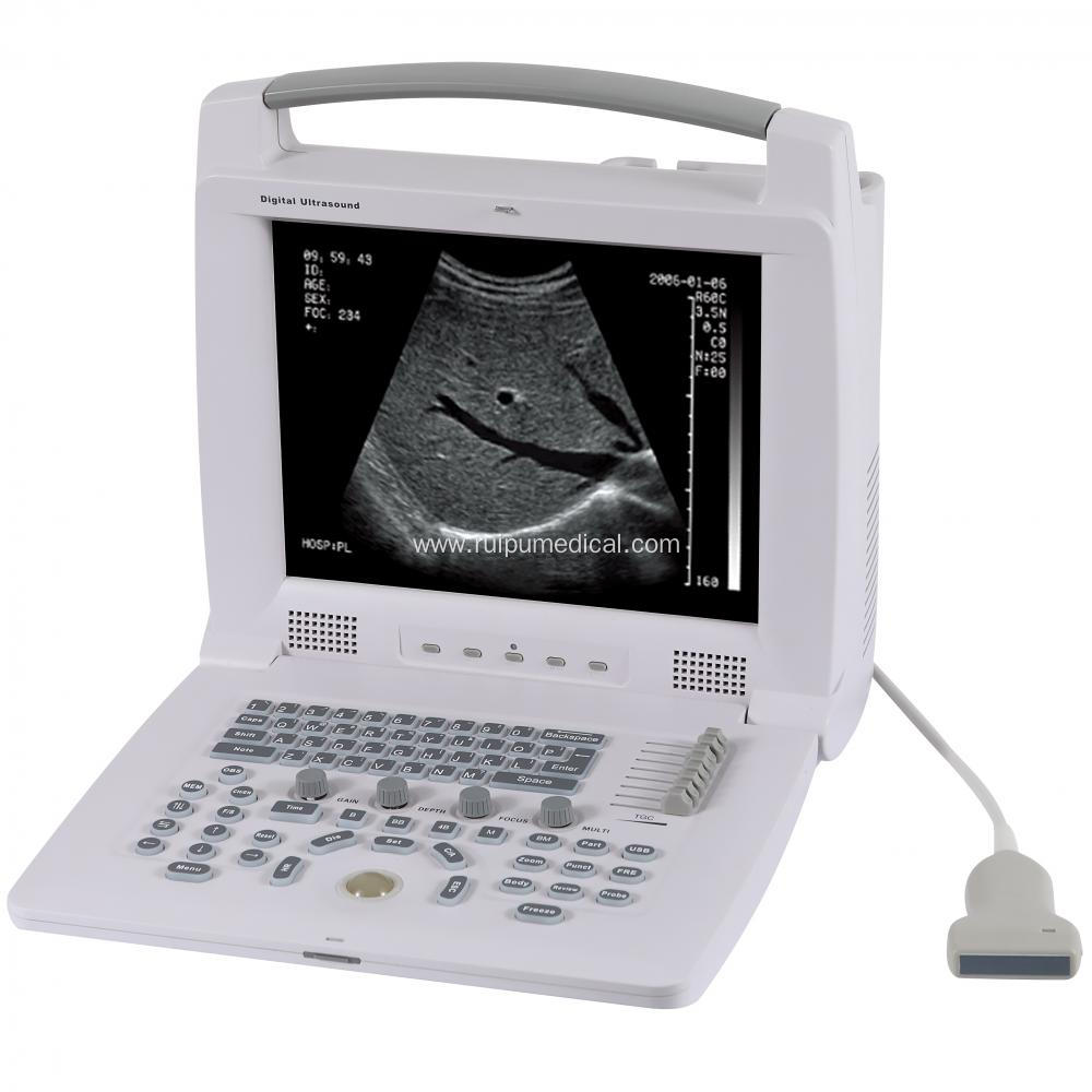 Portable Laptop Ultrasound Scanner Ultrasound Machine Price