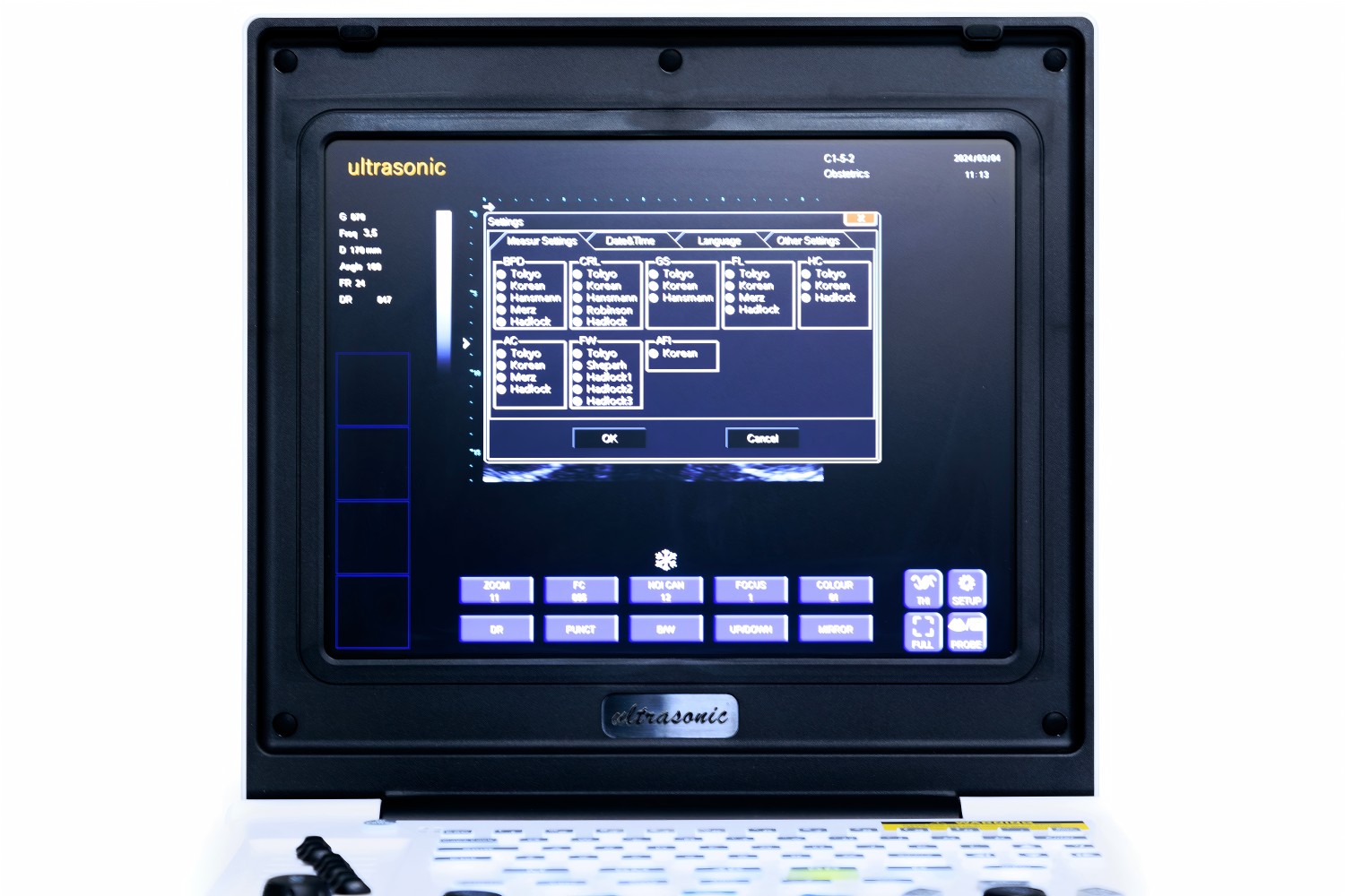 апарат сонограммы sonogram machine