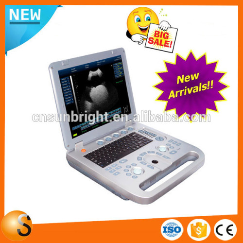 China portable ultrasound machine 3d ultrasound machine price