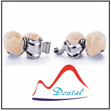 Dental Precision Attachment Denture