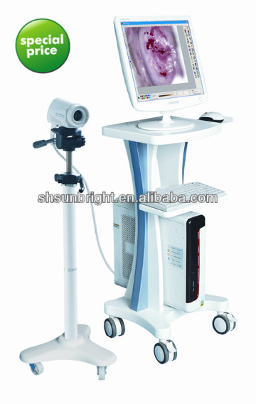 colposcope system