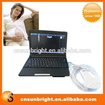 Baby OB ultrasound machine with OB report