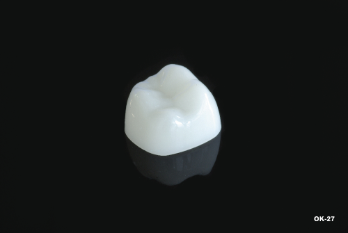 Dental Composite Molar/Premolar Covers ~ Veneer/Composite Crowns