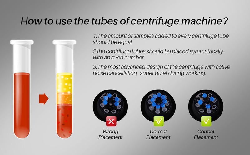 Low Speed Benchtop Lab Centrifuge