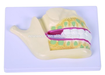 Deciduous teeth model