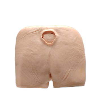 DARHMMY Advanced Medical Care Model for Pressure Ulcers