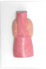 The parathyroid model