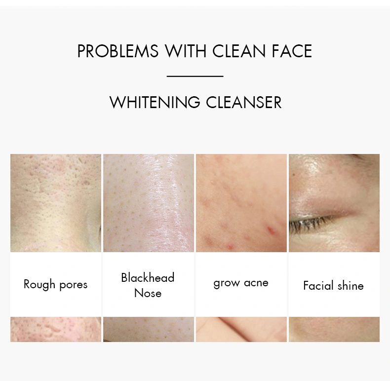 Amino Acid Cleanser Mild Cleansing Mousse Private Label Cleansing Foam Amino Acid Face Clean