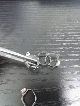 orthodontic 1st molar bands