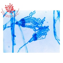 Fungi Prepared Slides: Penicillium Mould Preparation