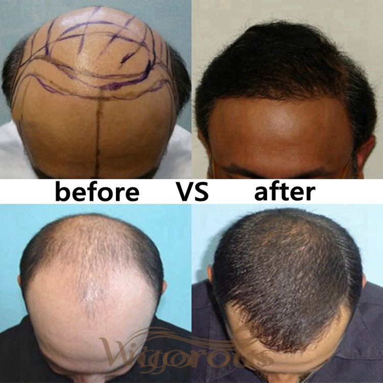 Natural Looking Men Toupee Human Hair Man Hairpieces 100% Human Hair Natural Black Machine Made Men Toupee With Clips