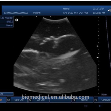 Ultrasonic Machine & 3D Color Doppler Ultrasound Scanner Price