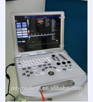 Portable 4D Color Doppler Ultrasound Scanner