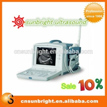 Digital Portable Ultrasound Machine / Ultrasound Scanner/ Portable Ultrasound