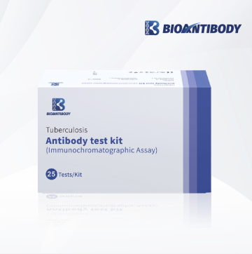 Premium Tuberculosis Antibody Test Kit