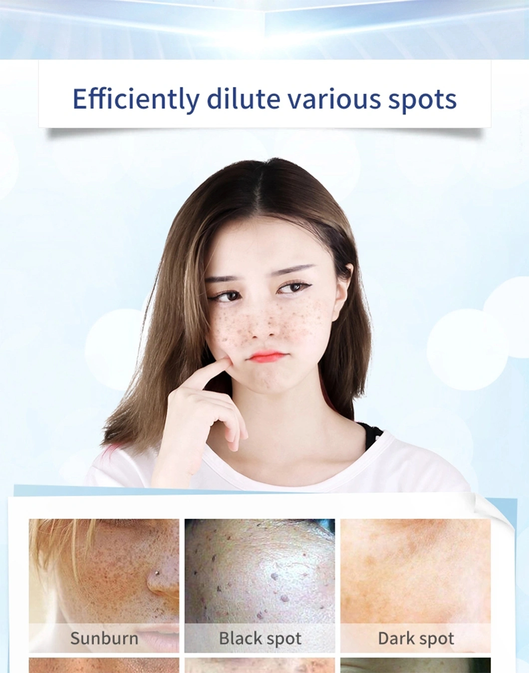 Wholesale OEM Private Label Freckle Cream for Fade Dark Spot