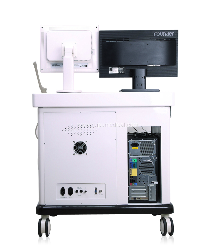 Hospital Digital Trolley Ultrasound Machine with Workstation