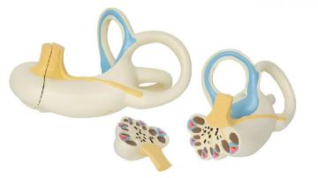 Anatomical enlargement of the inner ear