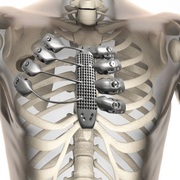 Dispositifs médicaux imprimés en 3D