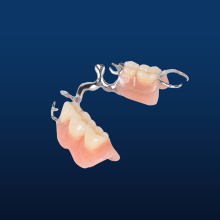 Metal Framework Partial Denture