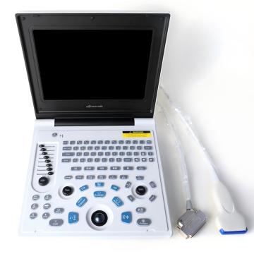 Male kidney stone ultrasound diagnostic instrument